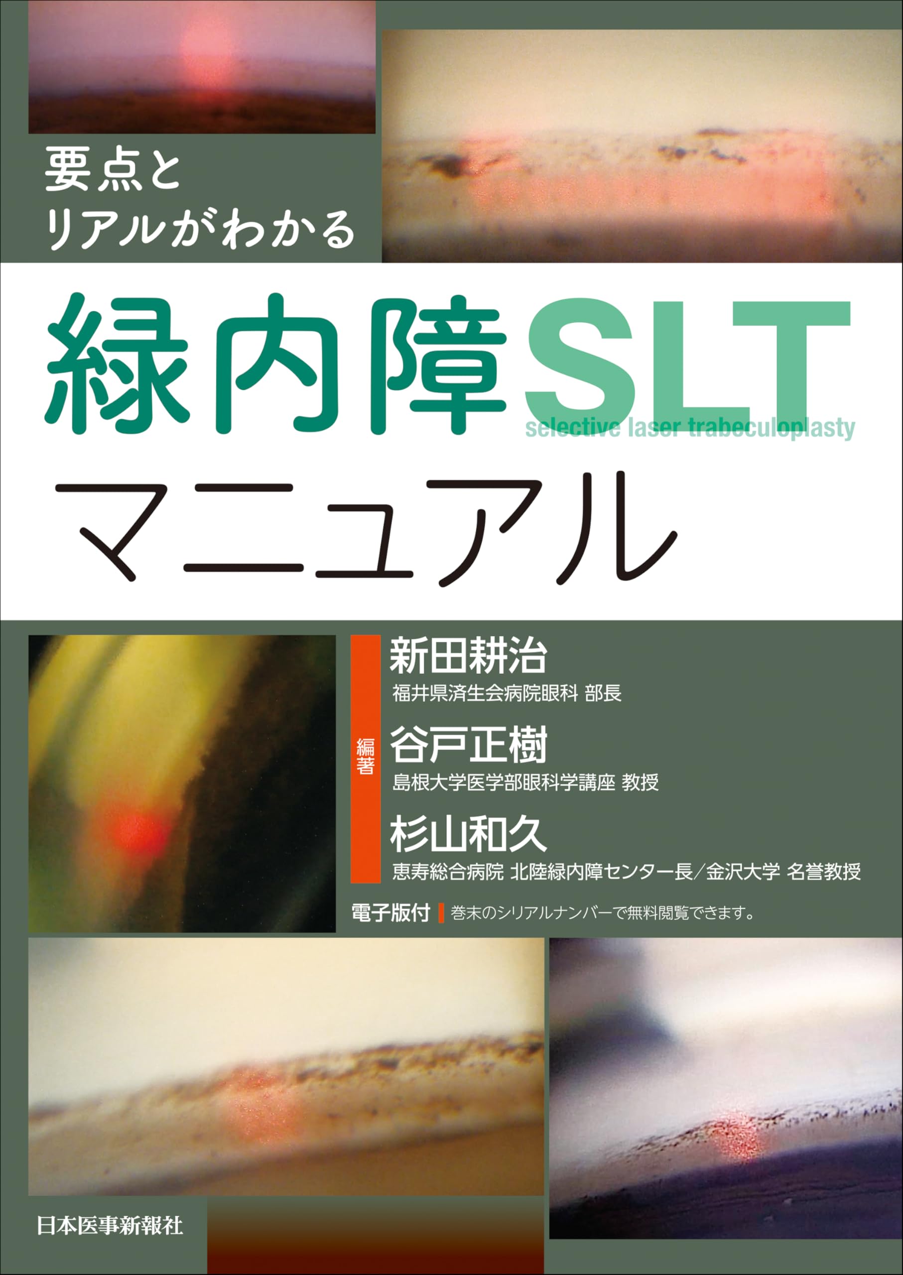 要点とリアルがわかる 緑内障SLTマニュアル | 新田耕治, 谷戸正樹
